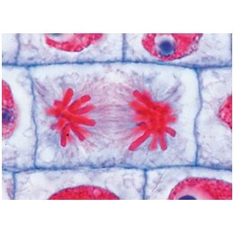 A mokyklinis rinkinys (bendroji biologija) - mikroskopiniai preparatai A mokyklinis rinkinys (bendroji biologija) - mikroskopiniai preparatai