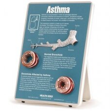 Astmos informacinis molbertas