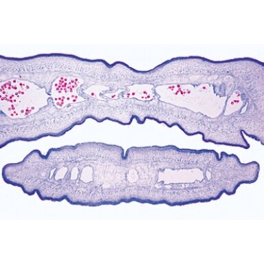 Bendroji parazitologija, rinkinys - mikroskopiniai preparatai Bendroji parazitologija, rinkinys - mikroskopiniai preparatai
