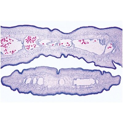 Bendroji parazitologija, rinkinys - mikroskopiniai preparatai Bendroji parazitologija, rinkinys - mikroskopiniai preparatai