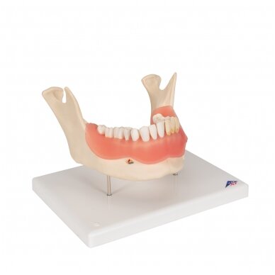 Dantų ligų modelis, 2x padidintas, 21 dalis 2