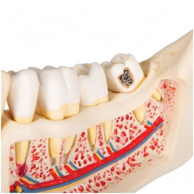 Dantų ligų modelis, 2x padidintas, 21 dalis 6