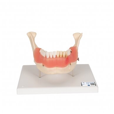Dantų ligų modelis, 2x padidintas, 21 dalis