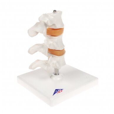 Deluxe žmogaus osteoporozės modelis (3 slanksteliai su diskais) , nuimamas ant stovo 3 Deluxe žmogaus osteoporozės modelis (3 slanksteliai su diskais) , nuimamas ant stovo 3