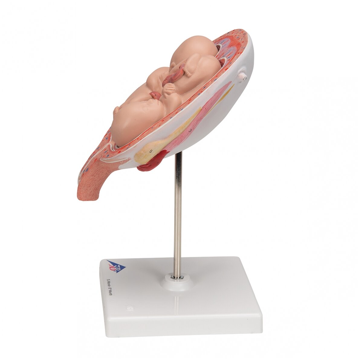 Dvynukų modelis, 5 mėnuo normalioje padėtyje 5 Dvynukų modelis, 5 mėnuo normalioje padėtyje 5