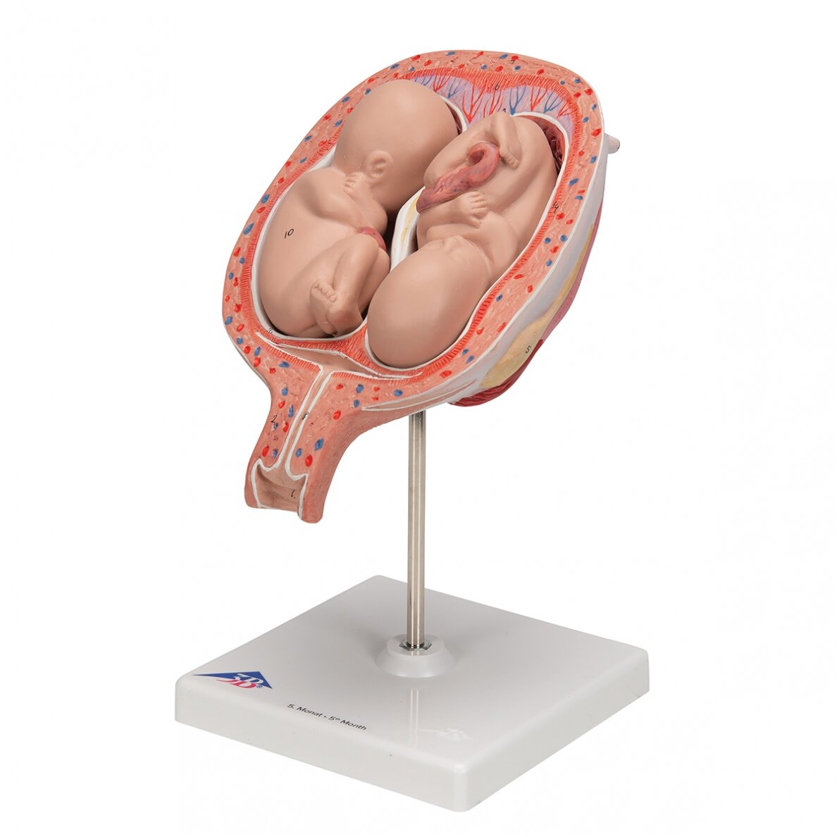 Dvynukų modelis, 5 mėnuo normalioje padėtyje 6 Dvynukų modelis, 5 mėnuo normalioje padėtyje 6