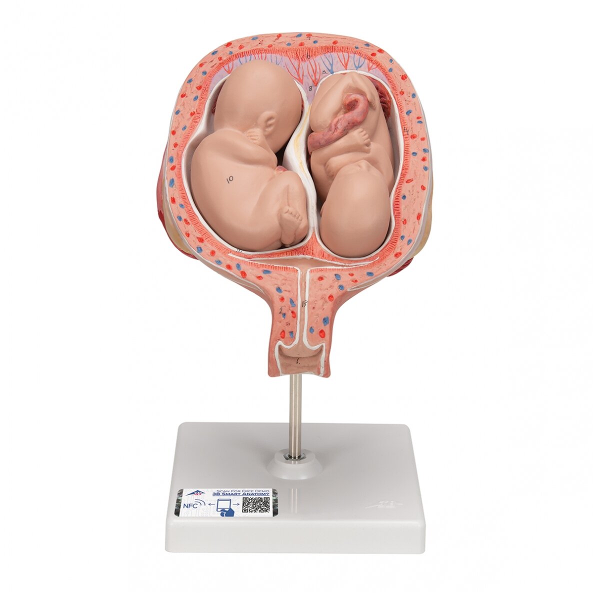 Dvynukų modelis, 5 mėnuo normalioje padėtyje Dvynukų modelis, 5 mėnuo normalioje padėtyje