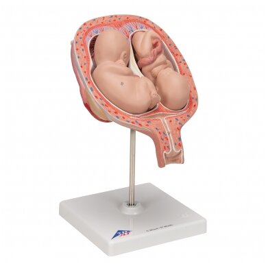 Dvynukų modelis, 5 mėnuo normalioje padėtyje 2 Dvynukų modelis, 5 mėnuo normalioje padėtyje 2