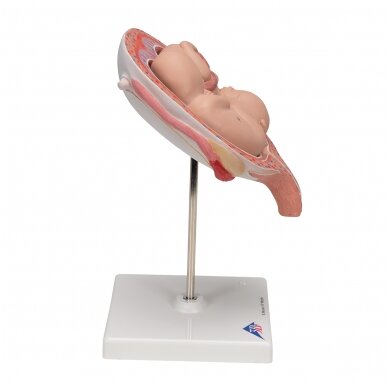 Dvynukų modelis, 5 mėnuo normalioje padėtyje 3