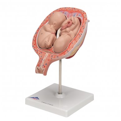 Dvynukų modelis, 5 mėnuo normalioje padėtyje 6 Dvynukų modelis, 5 mėnuo normalioje padėtyje 6