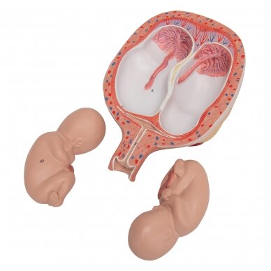 Dvynukų modelis, 5 mėnuo normalioje padėtyje 7