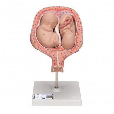 Dvynukų modelis, 5 mėnuo normalioje padėtyje Dvynukų modelis, 5 mėnuo normalioje padėtyje