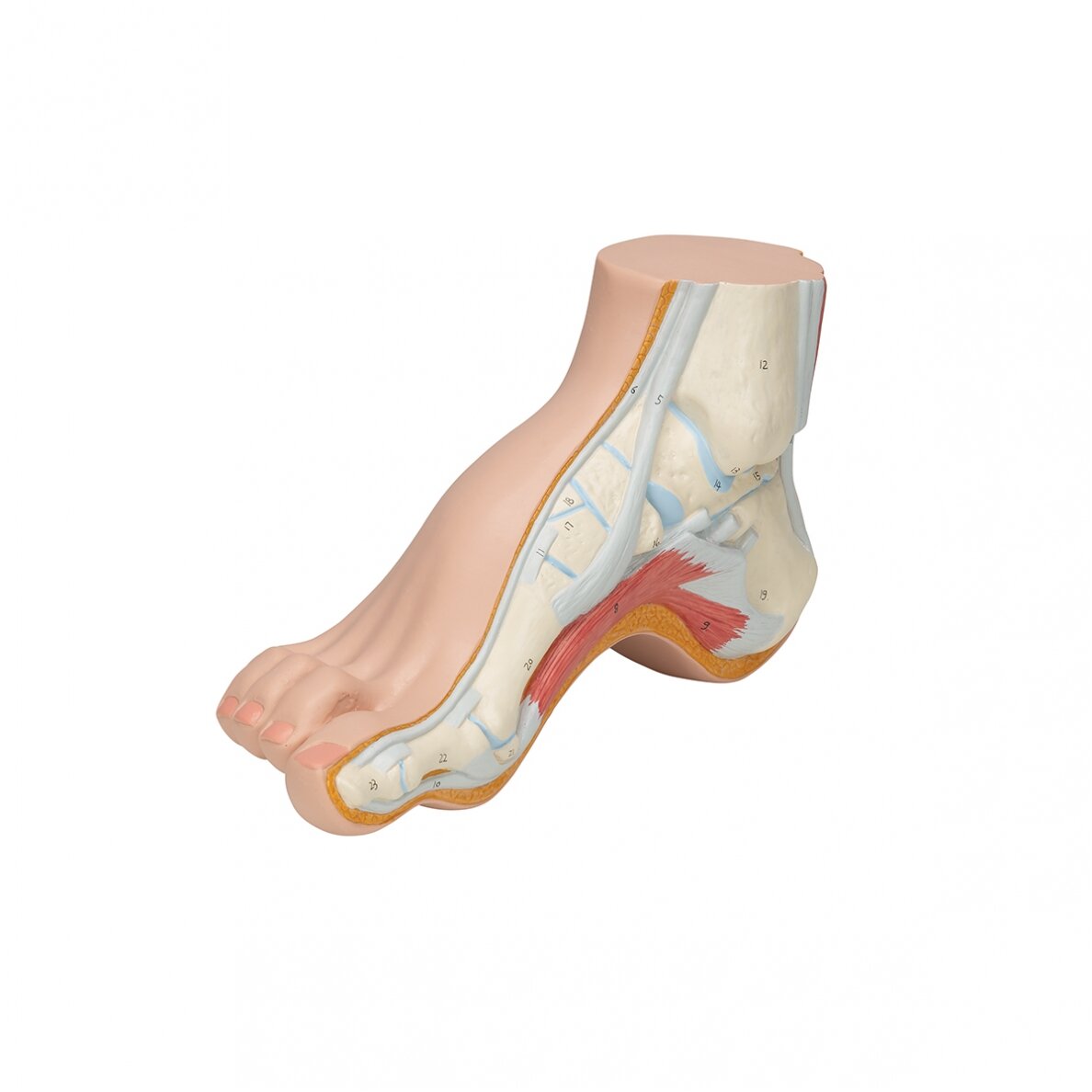 Gaubtos pėdos (Pes Cavus) modelis 6 Gaubtos pėdos (Pes Cavus) modelis 6