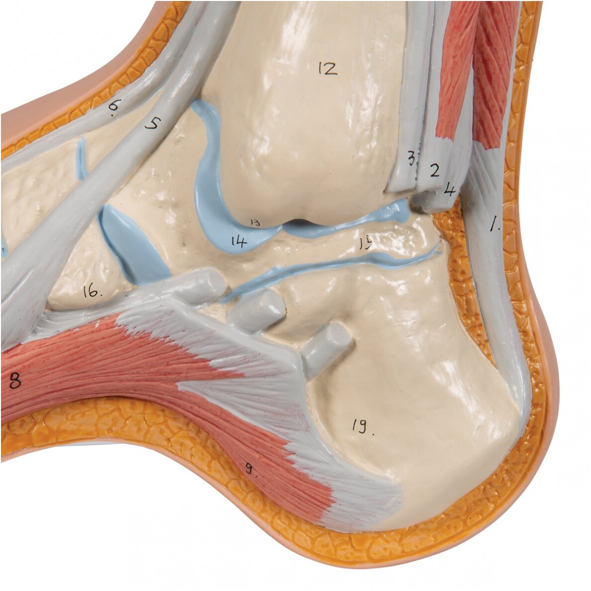 Gaubtos pėdos (Pes Cavus) modelis 7 Gaubtos pėdos (Pes Cavus) modelis 7