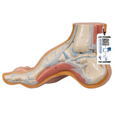 Gaubtos pėdos (Pes Cavus) modelis Gaubtos pėdos (Pes Cavus) modelis