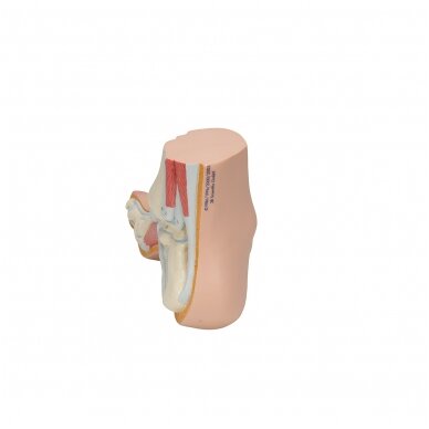 Gaubtos pėdos (Pes Cavus) modelis 4 Gaubtos pėdos (Pes Cavus) modelis 4