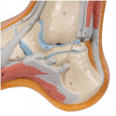 Gaubtos pėdos (Pes Cavus) modelis 7 Gaubtos pėdos (Pes Cavus) modelis 7