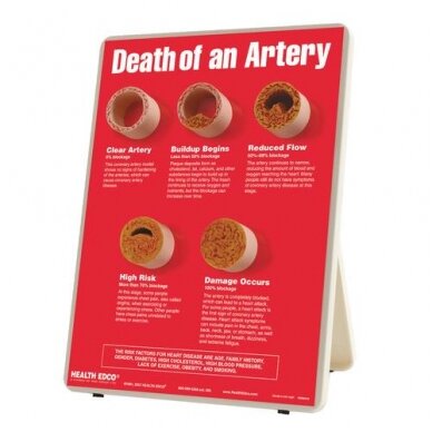 Informacinis stovas "Arterijos mirtis"
