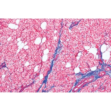 Įprasta žmogaus histologija, didelis rinkinys, II dalis - mikroskopiniai preparatai Įprasta žmogaus histologija, didelis rinkinys, II dalis - mikroskopiniai preparatai