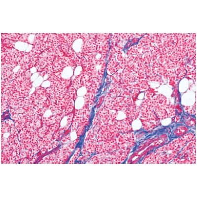 Įprasta žmogaus histologija, didelis rinkinys, II dalis - mikroskopiniai preparatai Įprasta žmogaus histologija, didelis rinkinys, II dalis - mikroskopiniai preparatai
