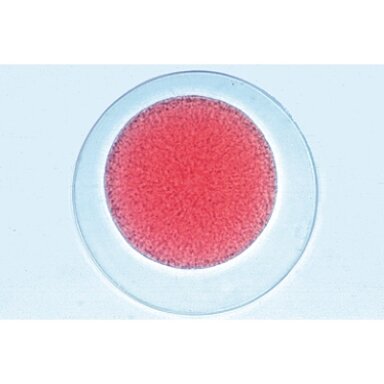 Jūrų ežių embriologija (Psammechinus miliaris) - mikroskopiniai preparatai Jūrų ežių embriologija (Psammechinus miliaris) - mikroskopiniai preparatai