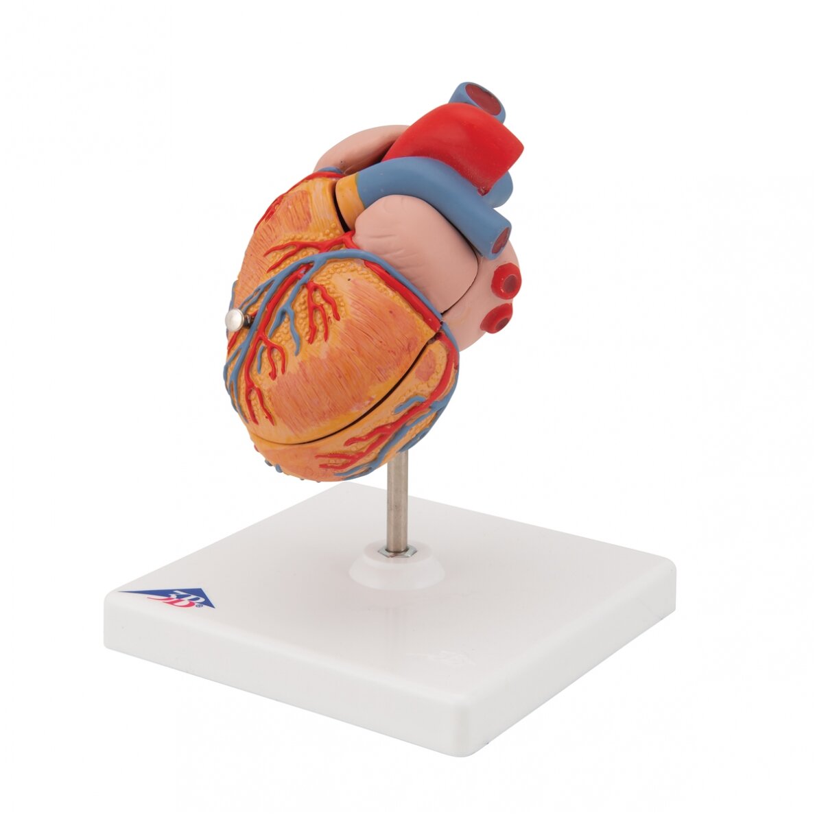 Klasikinis žmogaus širdies modelis su kairiojo skilvelio hipertrofija (LVH), 2 dalys 5 Klasikinis žmogaus širdies modelis su kairiojo skilvelio hipertrofija (LVH), 2 dalys 5