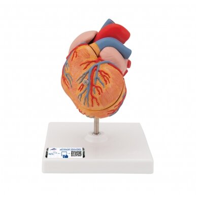 Klasikinis žmogaus širdies modelis su kairiojo skilvelio hipertrofija (LVH), 2 dalys Klasikinis žmogaus širdies modelis su kairiojo skilvelio hipertrofija (LVH), 2 dalys