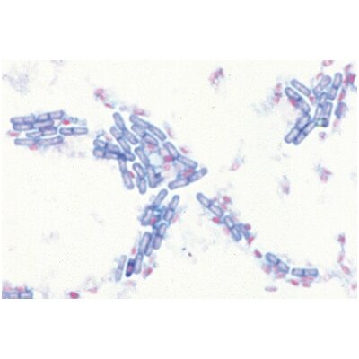 Kriptogamos, papildomas I rinkinys - mikroskopiniai preparatai Kriptogamos, papildomas I rinkinys - mikroskopiniai preparatai