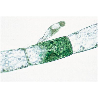 Kriptogamos, papildomas II rinkinys - mikroskopiniai preparatai Kriptogamos, papildomas II rinkinys - mikroskopiniai preparatai