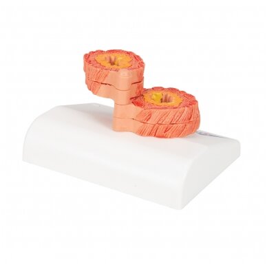 LOPL bronchų audinių modelis 4