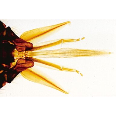 Medaus bitė (Apis mellifera) - mikroskopiniai preparatai Medaus bitė (Apis mellifera) - mikroskopiniai preparatai