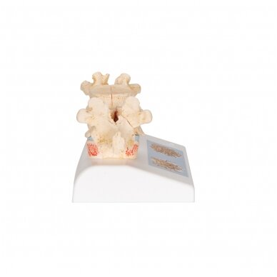 Osteoporozės didaktinis modelis 3 Osteoporozės didaktinis modelis 3