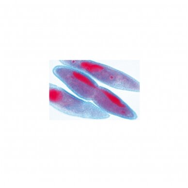 Paramaecium (Caudatum) - mikroskopiniai preparatai 2 Paramaecium (Caudatum) - mikroskopiniai preparatai 2