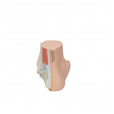 Pilnapadės pėdos (Pes Planus) modelis 4 Pilnapadės pėdos (Pes Planus) modelis 4