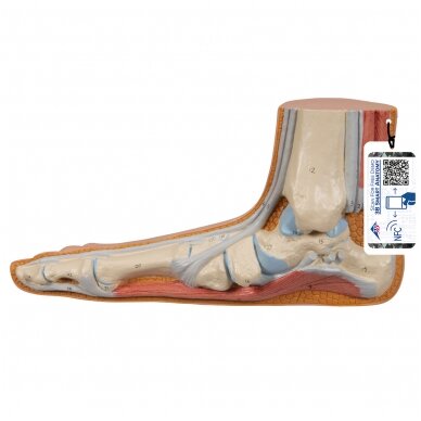 Pilnapadės pėdos (Pes Planus) modelis Pilnapadės pėdos (Pes Planus) modelis