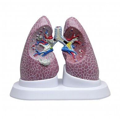 Plaučių modelis su patologijomis 1 Plaučių modelis su patologijomis 1