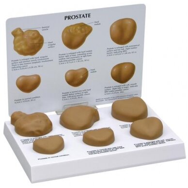 Prostatos modeliai Prostatos modeliai