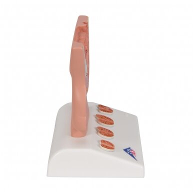 Prostatos modelis, 1/2 realaus dydžio 3 Prostatos modelis, 1/2 realaus dydžio 3