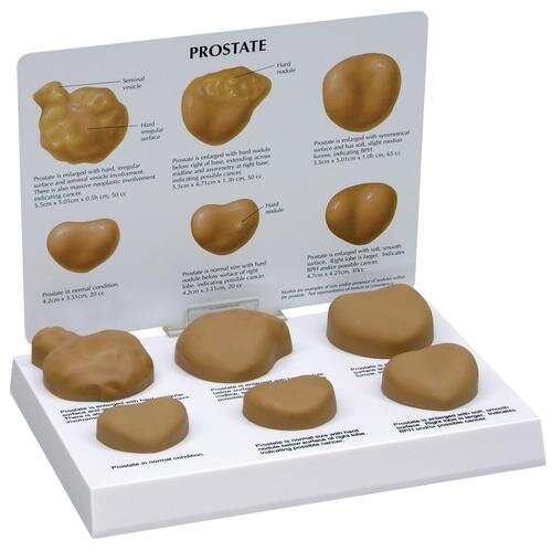 Prostatos modeliai Prostatos modeliai