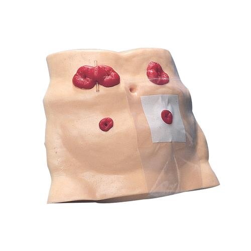 Stomos priežiūros modelis Stomos priežiūros modelis
