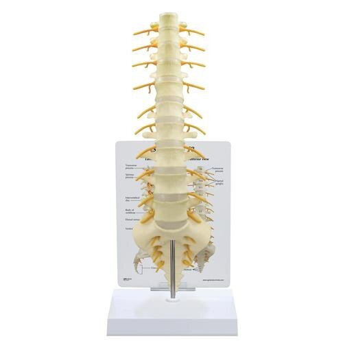 T8-T12 ir L-1-L-5 stuburo slankstelių modelis T8-T12 ir L-1-L-5 stuburo slankstelių modelis