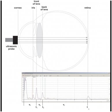 Ultragarsinės biometrijos akies modelis 1 Ultragarsinės biometrijos akies modelis 1