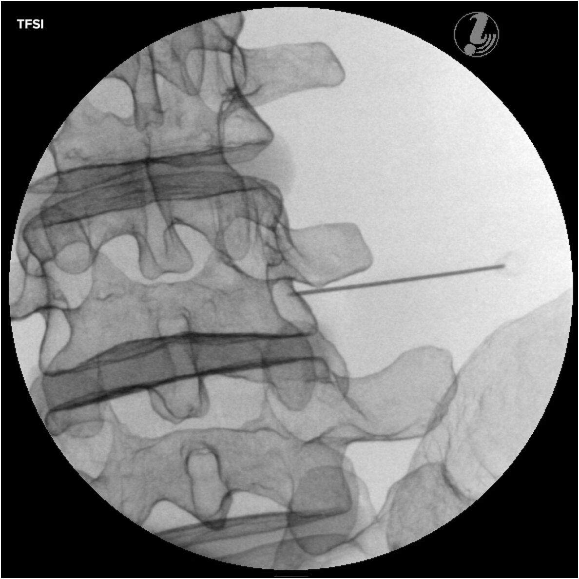 Vaizdinis juosmens stuburo injekcijų treniruoklis P65 6