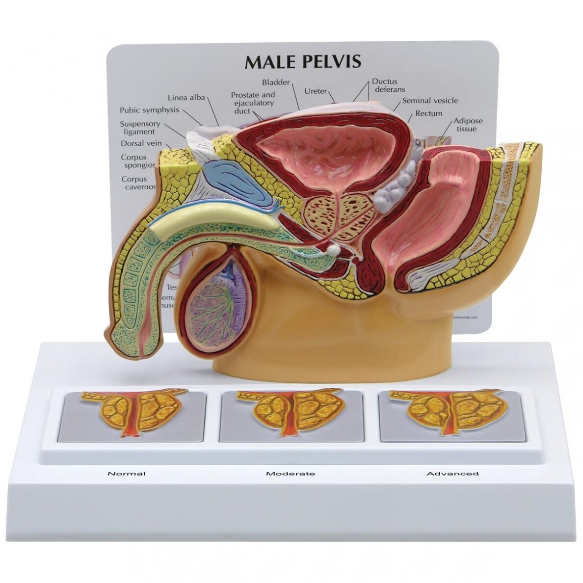 Vyro dubens skerspjūvis su 3D prostatos rėmu Vyro dubens skerspjūvis su 3D prostatos rėmu