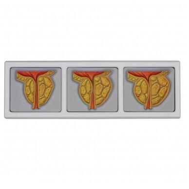 Vyro dubens skerspjūvis su 3D prostatos rėmu 1