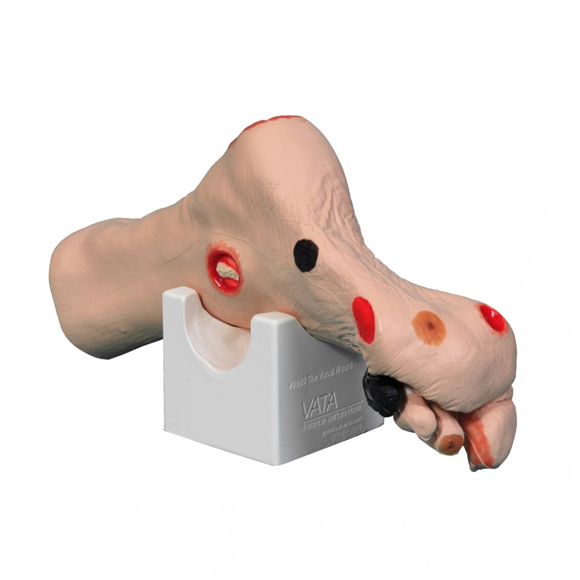 Wilma Wound Foot™ žaizduotos kojos modelis 2 Wilma Wound Foot™ žaizduotos kojos modelis 2