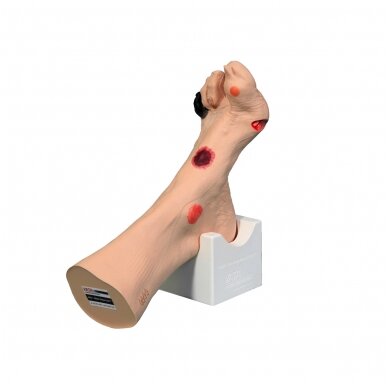 Wilma Wound Foot™ žaizduotos kojos modelis 1