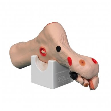 Wilma Wound Foot™ žaizduotos kojos modelis 2 Wilma Wound Foot™ žaizduotos kojos modelis 2