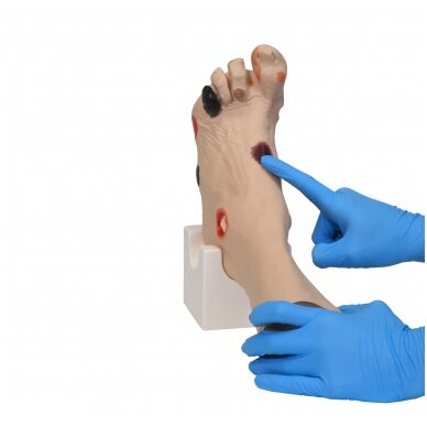 Wilma Wound Foot™ žaizduotos kojos modelis 3 Wilma Wound Foot™ žaizduotos kojos modelis 3