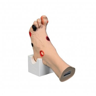Wilma Wound Foot™ žaizduotos kojos modelis Wilma Wound Foot™ žaizduotos kojos modelis